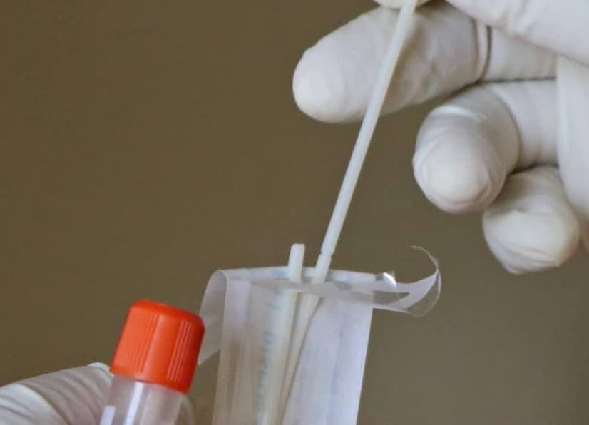 PCR Test In Nepal | List of COVID Testing Laboratories